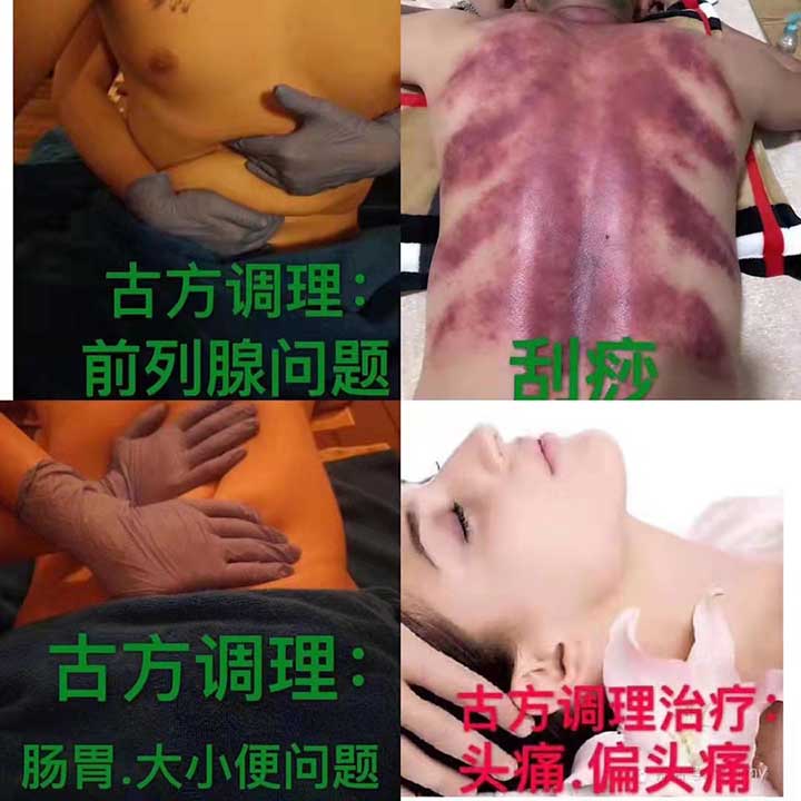 拔罐图.jpg